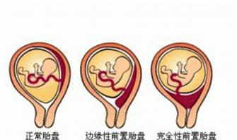 ̥?xi)?yng)ԓ֪@(g)ǰ̥P(pn)̫ΣU(xin)Jжt(y)Ժɹ΃U(xin)ǰ̥P(pn)a(chn)D